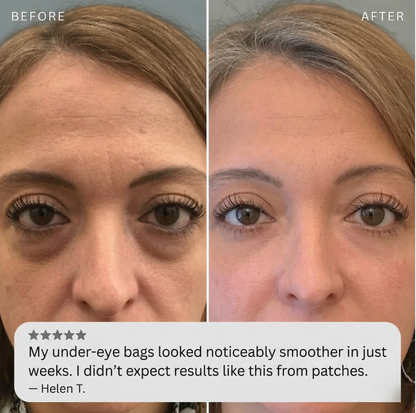 Ovalo Beauty MicroInfuse™ Eye Renewal Patches VIP